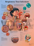 Respiratory Tract Infections - Anatomical Chart